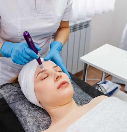 Rejuvenecimiento Facial en Fuengirola | Microneedling en Fuengirola