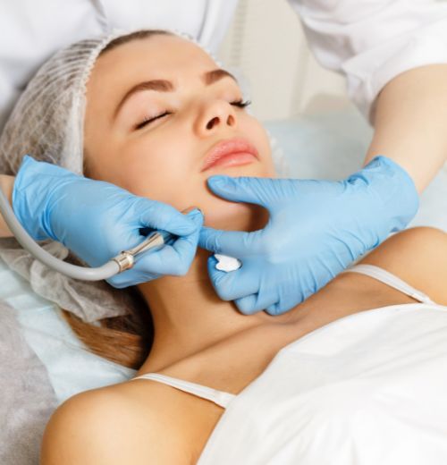 Limpieza Facial en Fuengirola | Hidrodermoabrasión en Fuengirola